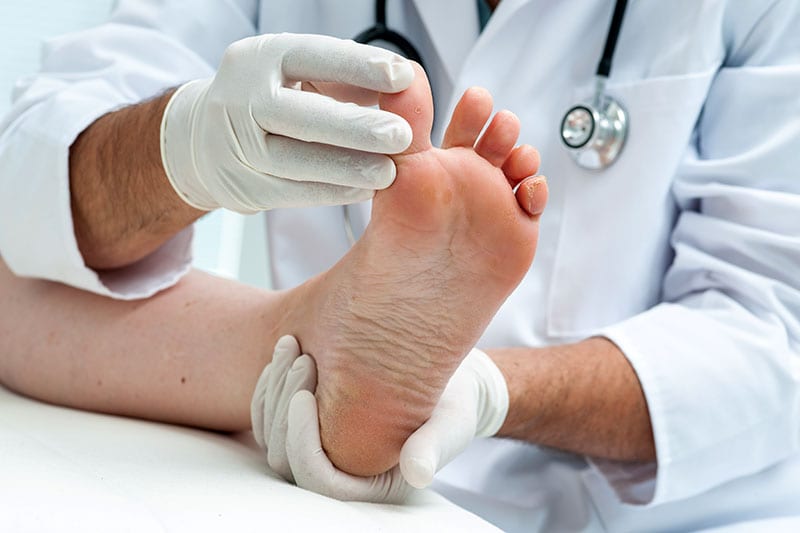 foot assessment treatment in chennai